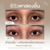 กล้ามเนื้อตาอ่อนแรง โคราช aline clinic