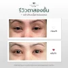 รีวิวแก้ไขกล้ามเนื้อตาอ่อนแรง โคราช