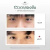 รีวิวแก้ไขกล้ามเนื้อตาอ่อนแรง โคราช