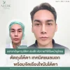 จัดเรียงไขมันใต้ตา จัดเรียงไขมันใต้ตา