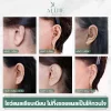 แผลดึงหน้าอลีนคลินิก
