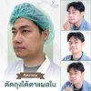 ตัดถุงใต้ตาแผลใน ตัดถุงใต้ตาแผลใน