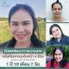 รีวิวดึงหน้าโคราช