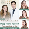 รีวิวดึงหน้า รีวิวดึงหน้า