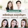 รีวิวตาสองชั้น แก้ตาสามชั้น รีวิวตาสองชั้น แก้ตาสามชั้น
