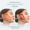ดึงหน้า Deep Plane คืออะไร ดึงหน้า Deep Plane คืออะไร