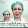 รีวิวศัลยกรรมยกคิ้วเอ็นโดไทน์ เทคนิค Endo - Fixtine แบบส่องกล้อง ที่ ALINE Clinic