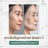 หน้าแก่ หน้าแก่