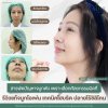 แก้จมูกโอเพ่น โคราช