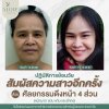 รีวิวดึงหน้าโคราช รีวิวดึงหน้าโคราช