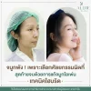เสริมจมูกโอเพ่น เสริมจมูกโอเพ่น