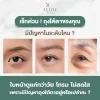 ถุงใต้ตา