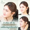 เสริมจมูกโอเพ่น