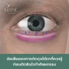 ข้อเสีย ตัดถุงใต้ตา ไม่ดี ข้อเสีย ตัดถุงใต้ตา ไม่ดี