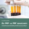 ฉีด PRP โคราช aline clinic