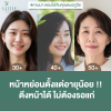 อายุน้อยดึงหน้า