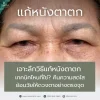 แก้หนังตาตก โคราช aline clinic