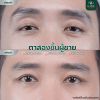 Review ตาสองชั้นผู้ชาย