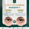 ถุงใต้ตา กับ ดอลลี่อาย ต่างกันอย่างไร? ถุงใต้ตา กับ ดอลลี่อาย ต่างกันอย่างไร?