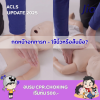 CPR เด็กเล็ก ใช้นิ้วหรือส้นมือ? CPR เด็กเล็ก ใช้นิ้วหรือส้นมือ?