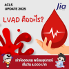 LVAD คืออะไร? LVAD คืออะไร?