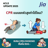 CPR แบบยกหัวสูงทำได้ไหม? CPR แบบยกหัวสูงทำได้ไหม?
