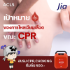เป้าหมายของการไหลเวียนเลือดขณะ CPR ? เป้าหมายของการไหลเวียนเลือดขณะ CPR ?