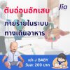 โรค : ตับอ่อนอักเสบ โรค : ตับอ่อนอักเสบ