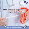 PCOS: โรคที่พบบ่อยที่สุดในผู้หญิงวัยเจริญพันธุ์ — แต่ถูกวินิจฉัยผิดมากที่สุดด้วย