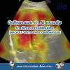 นักศึกษา มจธ. ทำ AI ตรวจตับ ช่วยรักษามะเร็งให้คนไทย รู้ผลไวใน 7 วินาที ลดค่าตรวจเหลือหลักร้อย! นักศึกษา มจธ. ทำ AI ตรวจตับ ช่วยรักษามะเร็งให้คนไทย รู้ผลไวใน 7 วินาที ลดค่าตรวจเหลือหลักร้อย!