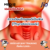 เฉลยข้อสอบ MEQ: ภาวะต่อมไทรอยด์เป็นพิษ (Thyrotoxicosis) เฉลยข้อสอบ MEQ: ภาวะต่อมไทรอยด์เป็นพิษ (Thyrotoxicosis)