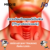 ตัวอย่างข้อสอบ MEQ: ภาวะต่อมไทรอยด์เป็นพิษ (Thyrotoxicosis) ตัวอย่างข้อสอบ MEQ: ภาวะต่อมไทรอยด์เป็นพิษ (Thyrotoxicosis)