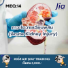 ตัวอย่างข้อสอบ MEQ: ภาวะไตวายเฉียบพลัน (Acute Kidney Injury) ตัวอย่างข้อสอบ MEQ: ภาวะไตวายเฉียบพลัน (Acute Kidney Injury)