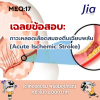 เฉลยข้อสอบ: ภาวะหลอดเลือดสมองตีบเฉียบพลัน  (Acute Ischemic Stroke)