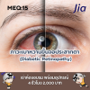 ตัวอย่างข้อสอบ MEQ: ภาวะเบาหวานขึ้นจอประสาทตา (Diabetic Retinopathy)