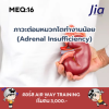  ตัวอย่างข้อสอบ MEQ: ภาวะต่อมหมวกไตทำงานน้อย (Adrenal Insufficiency)