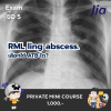 RML ling abscess.เลือกใช้ ATB ใด? RML ling abscess.เลือกใช้ ATB ใด?