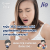 หญิง 35 ปี ตรวจพบ mild papilledema จากการกินยา อาหารเสริมเวลานาน? หญิง 35 ปี ตรวจพบ mild papilledema จากการกินยา อาหารเสริมเวลานาน?