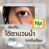 วิธีแก้ไขใต้ตาบวมน้ำจากโซเดียม