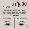 ยากุ้งยิง Hordeolum / Chalazion