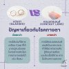 แว่นตา VS คอนแทคเลนส์