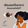 เลือดออกในตาขาวอันตรายหรือไม่? เลือดออกในตาขาวอันตรายหรือไม่?