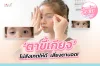 ตาขี้เกียจ ไม่สังเกตให้ดี อาจเสี่ยงตาบอด! ตาขี้เกียจ ไม่สังเกตให้ดี อาจเสี่ยงตาบอด!
