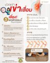 อาการเข่าเสื่อม การรักษา ป้องกัน อาการเข่าเสื่อม การรักษา ป้องกัน