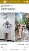 Review Gastrectomy
