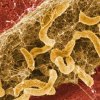 การเกิด Biofilm ในระบบผลิตน้ำบริสุทธิ์และวิธีกำจัด Biofilm