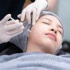 Ingin Mencoba Prosedure Mesotherapy? Ini Penjelasannya.