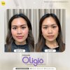 Oligio