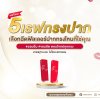 5 เรฟทรงปาก 5 เรฟทรงปาก