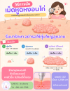 เลเซอร์หูดหงอนไก่ จี้เย็นหูด จี้หูด รักษาหูด คลินิกเลเซอร์หูด